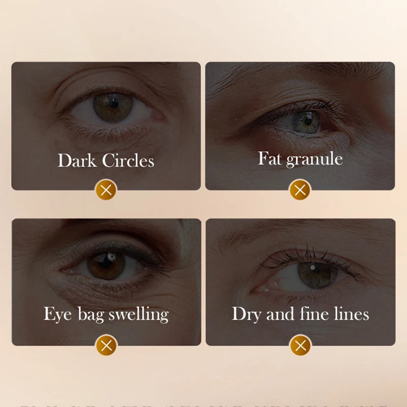 Crema contorno de ojos antienvejecimiento SADOER
